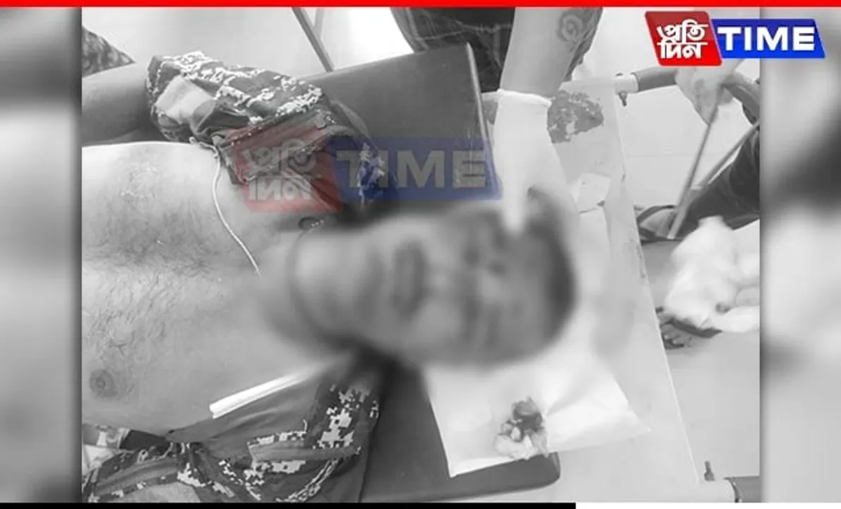Manipur: Kuki Militants Ambush Security Forces in Jiribam, 1 CRPF Jawan Dead